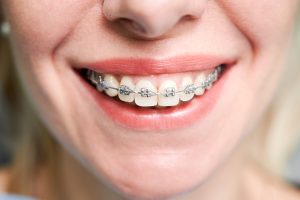 Orthodontists Treatment