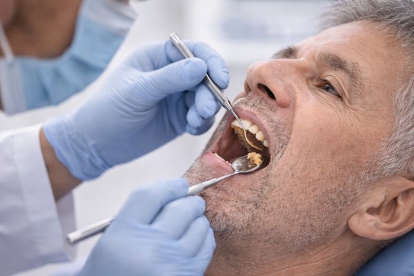 Why Does Food Get Stuck Between My Teeth?